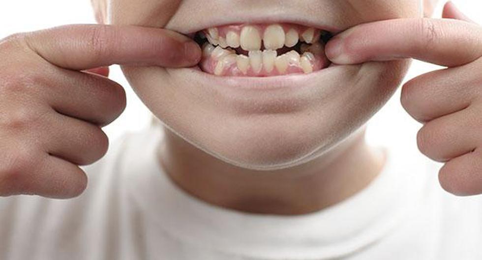 Brackets 7